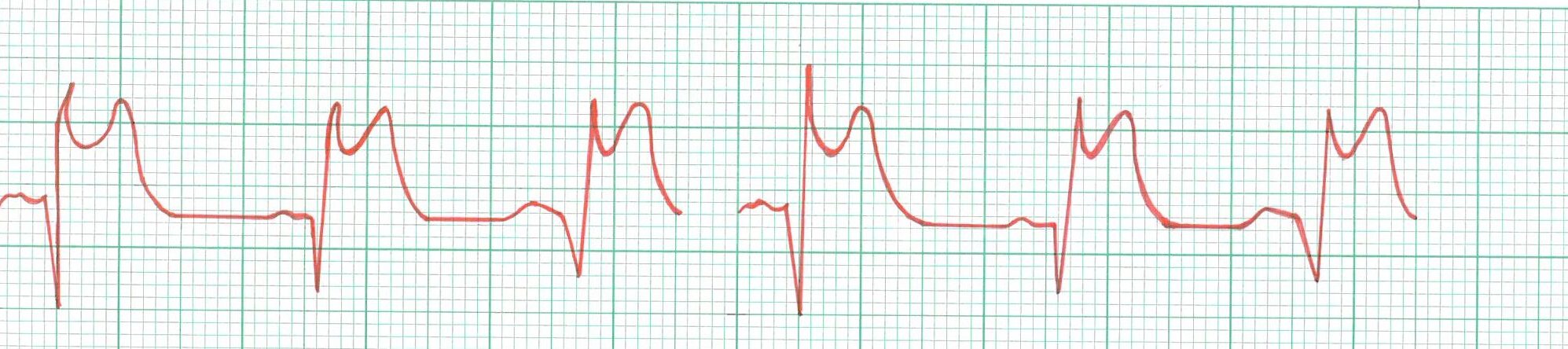 13 CPDs Intermediate/Advanced ECG Course