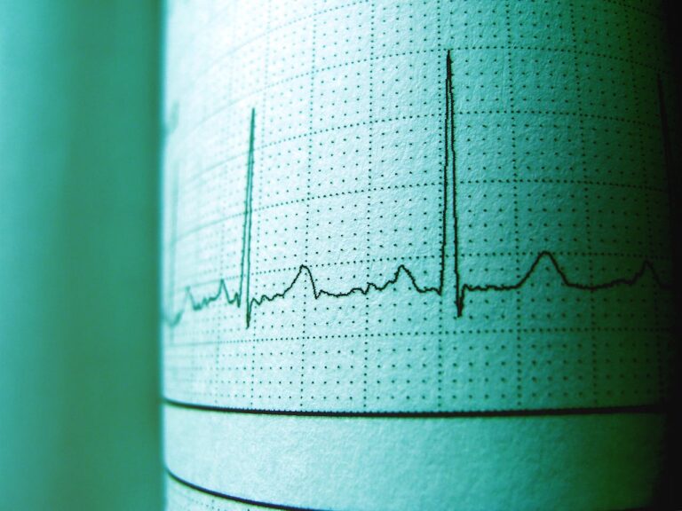 30 CPDs: ECG Course for Healthcare Practitioners